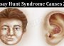 Latest News Ramsay Hunt Syndrome Causes 2022