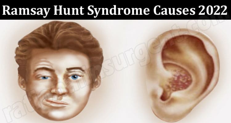 Latest News Ramsay Hunt Syndrome Causes 2022