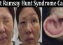 Latest News What Ramsay Hunt Syndrome Causes