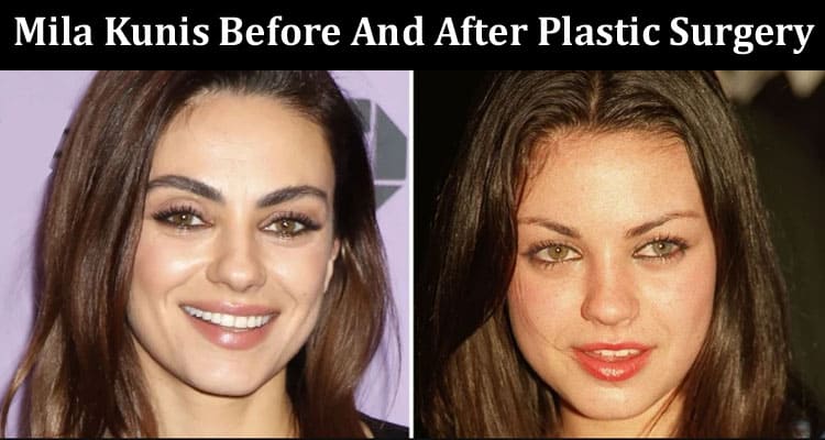 Latest News Mila Kunis Before And After Plastic Surgery
