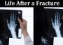 Life After a Fracture - Regain Your Mobility Slowly but Surely