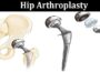 Complete Guide toInformation Hip Arthroplasty