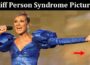 Latest News Stiff Person Syndrome Pictures
