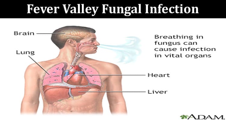 Latest News Fever Valley Fungal Infection