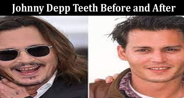 Latest News Johnny Depp Teeth Before And After