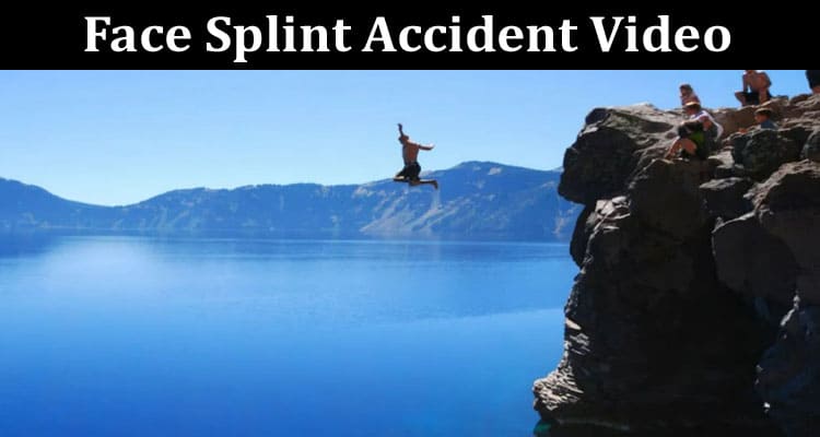 Latest News Face Splint Accident Video