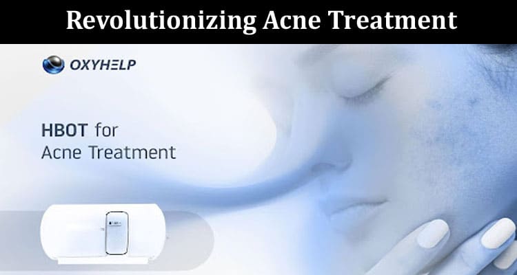 Complete Details Revolutionizing Acne Treatment