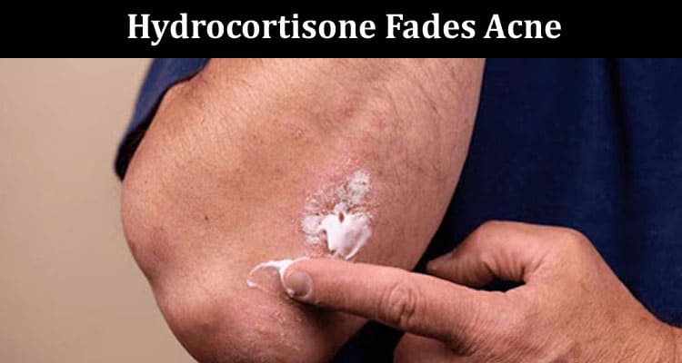Decoding Whether Hydrocortisone Fades Acne Marks and Dark Spots