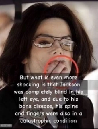 Michael Jackson Autopsy Pictures