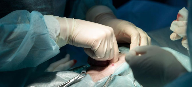 Disturbing C-section Practices Discovered by Nurses